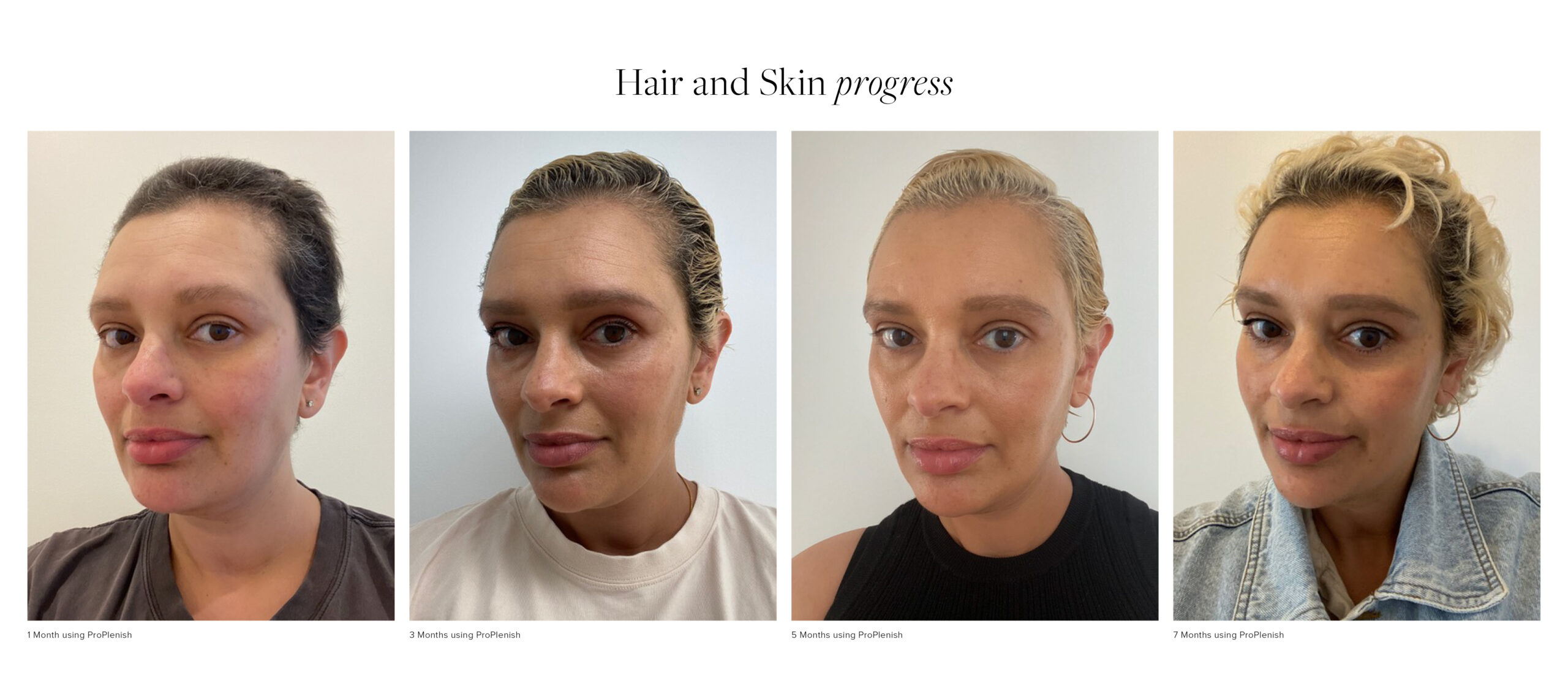 Cancer recovery with ProPlenish