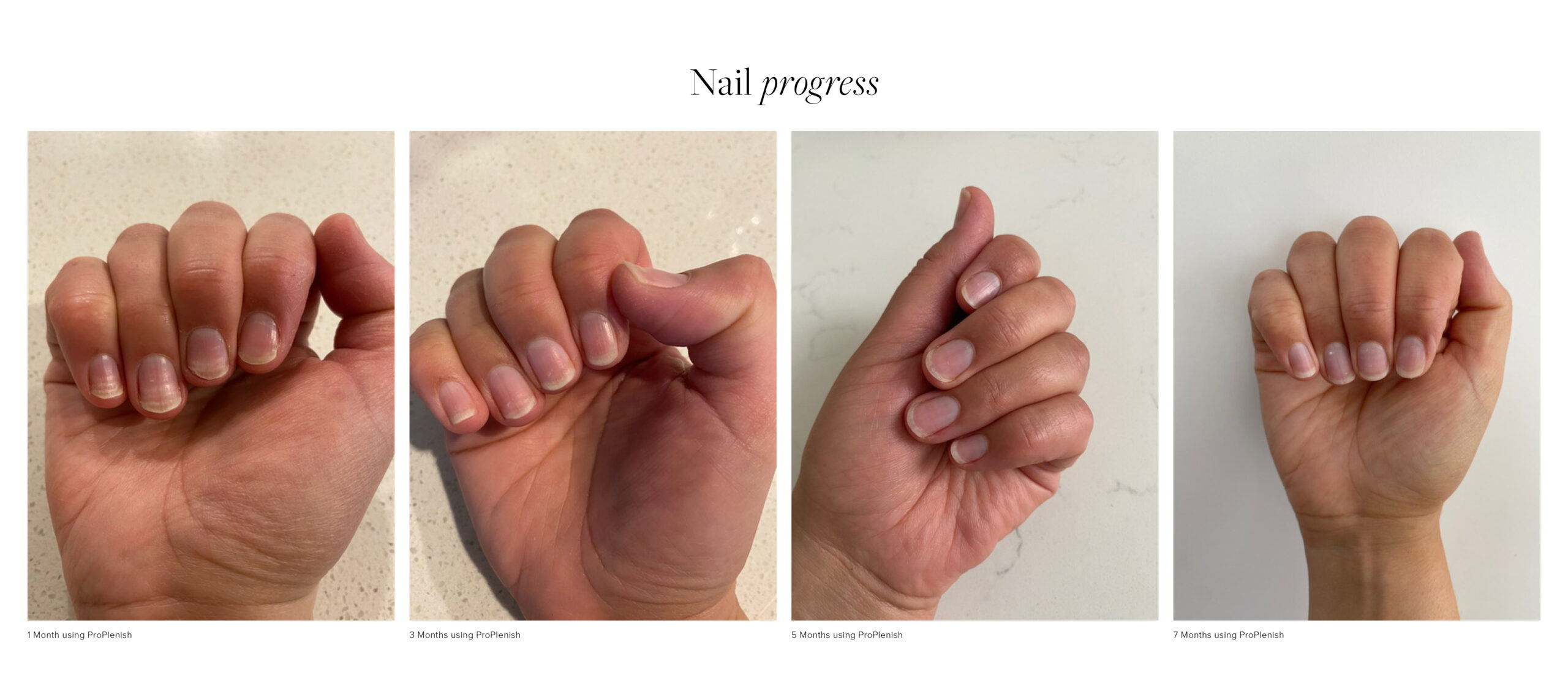 Cancer recovery with ProPlenish